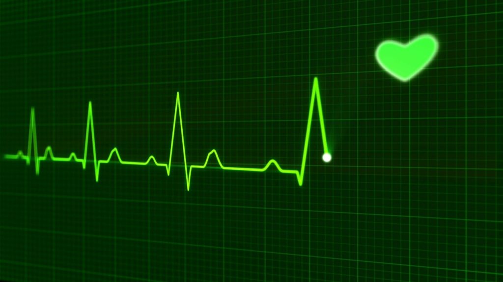 heartbeat-163709_1280-1024x576 Managed Monitoring